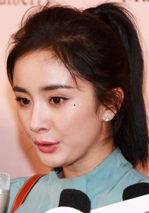 明星眼有疤痕,揭秘明星眼中的故事